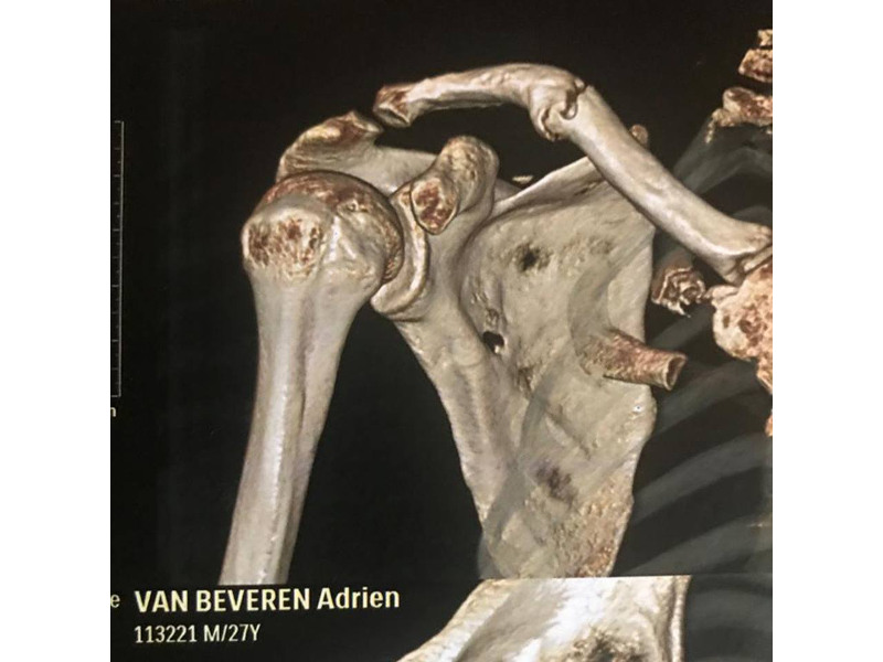 Adrien van Beveren: Έσπασε ξανά την ίδια κλείδα!