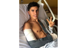 Marc Marquez - Μόλυνση στο σπασμένο χέρι, παραμένει στο νοσoκομείο!